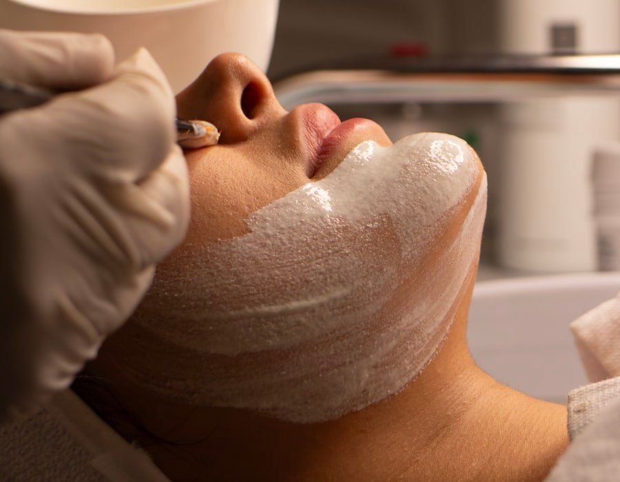 Sesión de microneedling con Dermapen