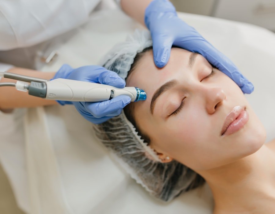Peeling facial aplicado por una especialista